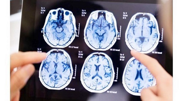 ����� ������.. ���� ����� ��������� �����