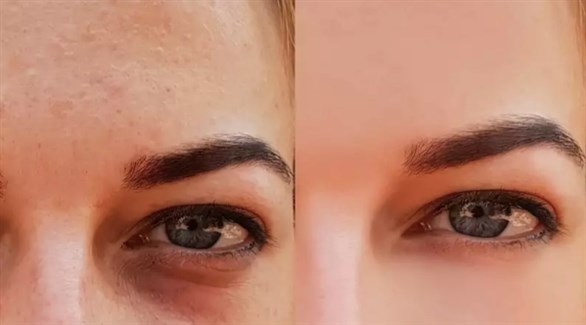 4 ��� ������ ����� ������ �������