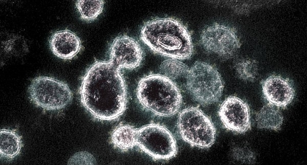 �� ���� ����� ���� �� ���� ������ǻ