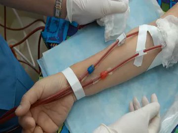 2400 مريض غسيل كلى في الكويت أغلبهم من الرجال .. بزيادة 2 في المئة عن العام الماضي 